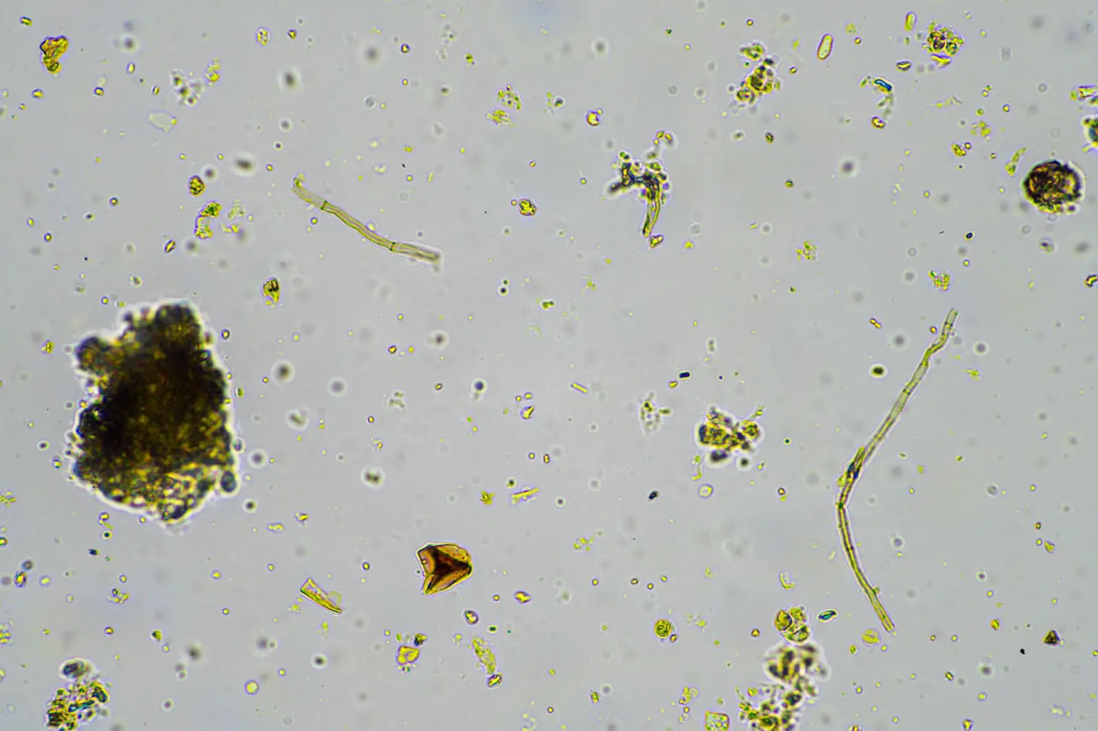 Cannabis soil microbes.